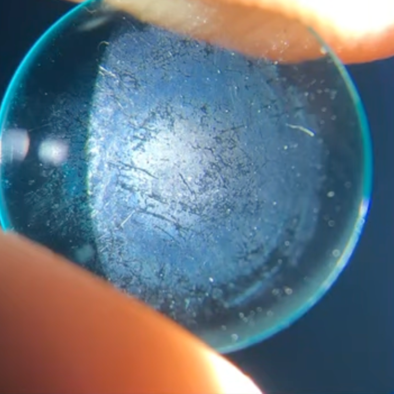 Lens contaminated with protein and germs